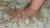 fish foot massage
